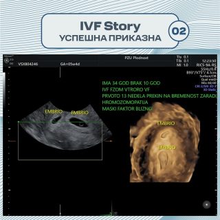 Ivf Stories: Inspiring Journeys To Parenthood