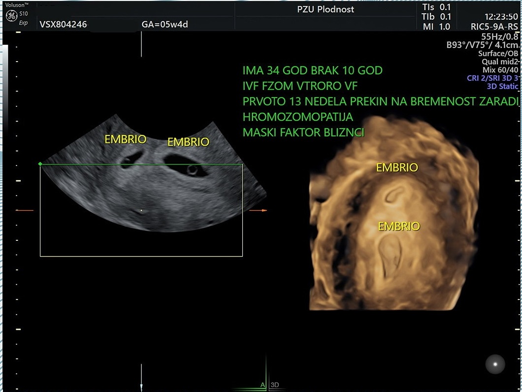 ivf-stories-inspiring-journeys.jpg