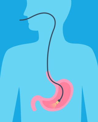 Gastroscopy