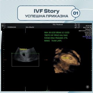 Ivf Story: A Journey Filled With Perseverance And Hope