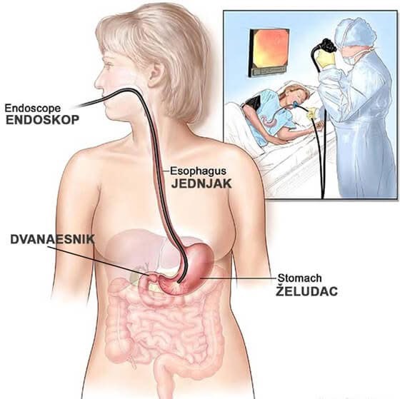 gastroscopy-intermed-plodnost-bitola.jpg