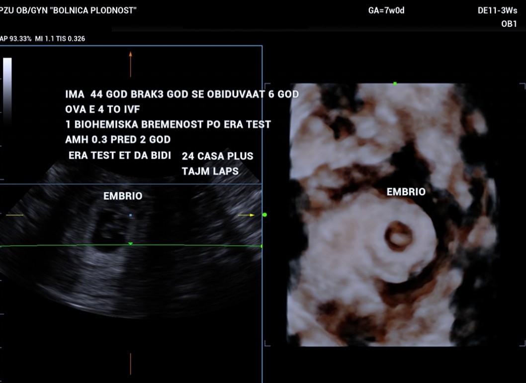 Emprio X Ray Scan Ivf