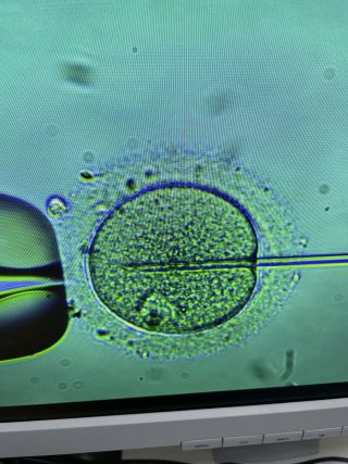 Embrio IVF Plodnost Hospital