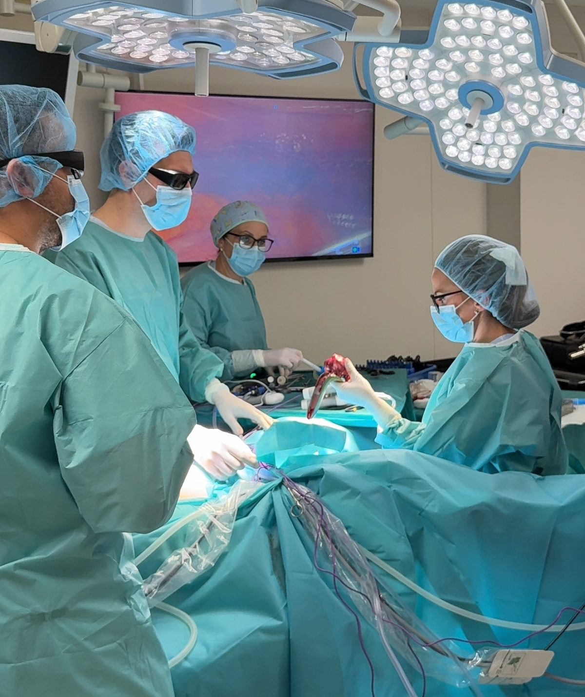 10 Laparoscopic Surgerieas Success Weekly Plodnost Bitola