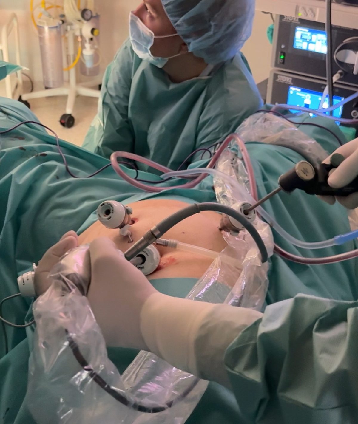 10 Laparoscopic Surgery Success Weekly