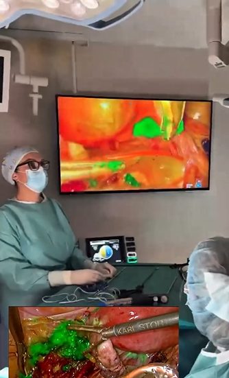 3d Advanced Laparoscopic Hysterectomy
