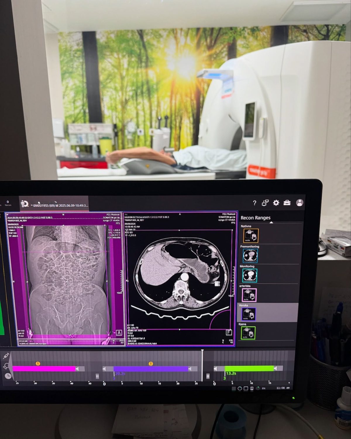 Ct Scans Plodnost Somatom Simens Go Up