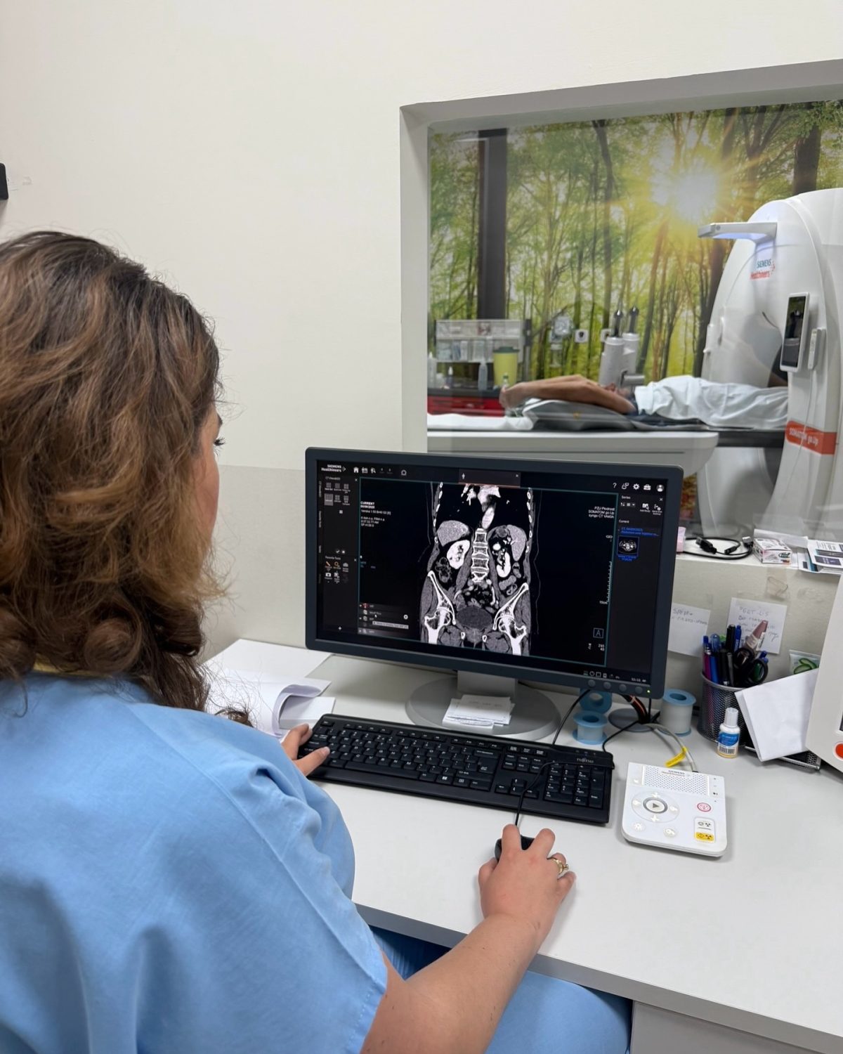 Ct Scans Plodnost Somatom Simens Go Up Plodnost