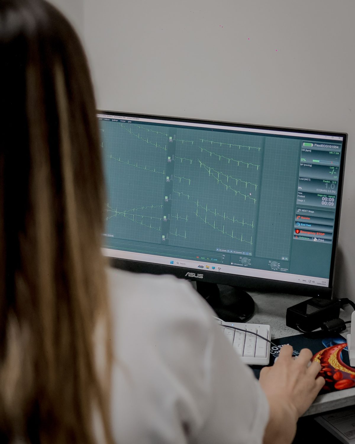 Plodnost Intermed Monitoring Dr Shishkovska