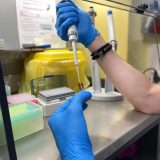 Ureaplasma Featured